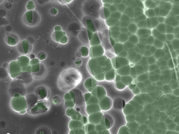 L’immagine di un microscopio elettronico mostra l’enzima che digerisce la materia plastica PET.