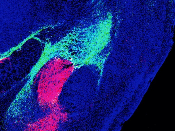 In verde la regione del talamo e in rosso la regione del tronco encefalico che inviano segnali all’amigdala