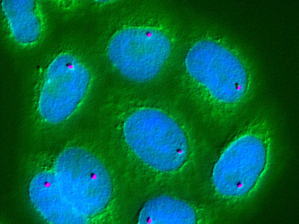 La mappatura della posizione dei geni nel nucleo cellulare fa luce sui principi di base che governano il genoma. Qui, un singolo gene chiamato Pem (viola) è stato localizzato utilizzando l'ibridazione in situ a fluorescenza. Il DNA è macchiato di blu; il citoplasma cellulare è colorato di verde.
