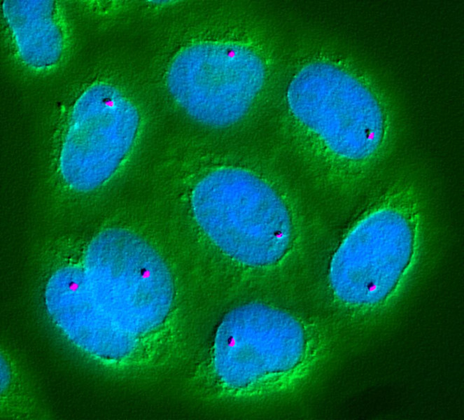 La mappatura della posizione dei geni nel nucleo cellulare fa luce sui principi di base che governano il genoma. Qui, un singolo gene chiamato Pem (viola) è stato localizzato utilizzando l'ibridazione in situ a fluorescenza. Il DNA è macchiato di blu; il citoplasma cellulare è colorato di verde.