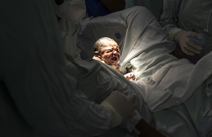Santo Domingo (Repubblica Dominicana). La nascita del piccolo Damian all'ospedale di maternità di Altagracia. Il bambino, il primo nato il 15 novembre, è stato simbolicamente scelto per rappresentare il contributo del Paese al raggiungimento del traguardo, annunciato dall'Onu, delle 8 miliardi di persone che popolano il pianeta.
