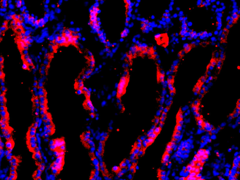 Cellule umane (in rosso) in un rene allevato in un maiale