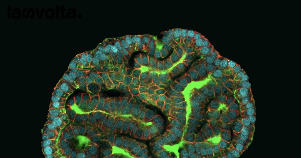 Creati mini organi dalle cellule fetali recuperate dal liquido amniotico