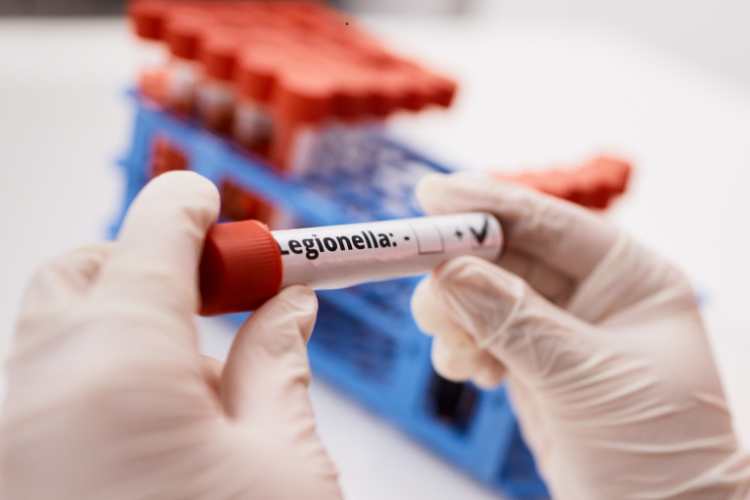 Legionella - fonte_Canva - LaSvolta.it